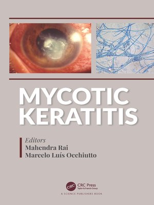 cover image of Mycotic Keratitis